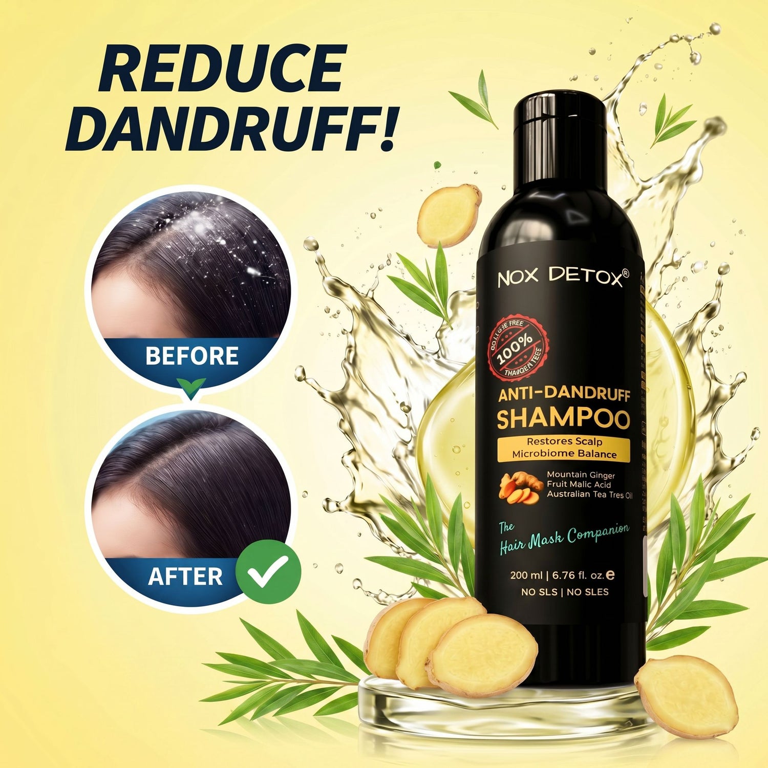 Anti-Dandruff Shampoo