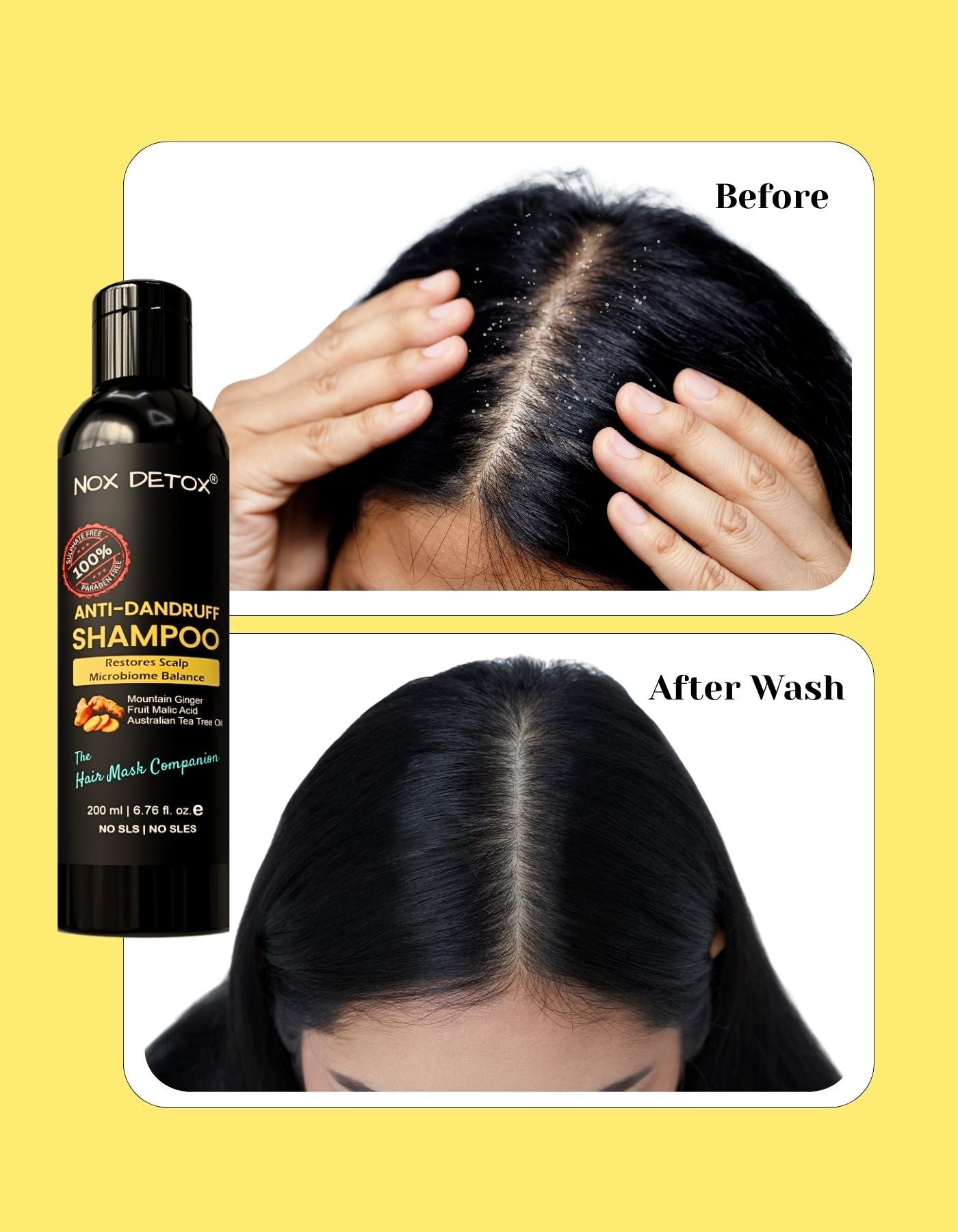 Anti-Dandruff Shampoo