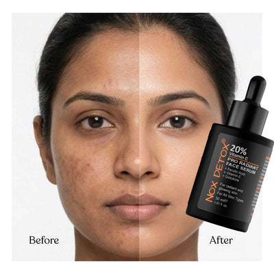 Pro Radiant 20% Vitamin C Face Serum for Dark Spots (30ml)