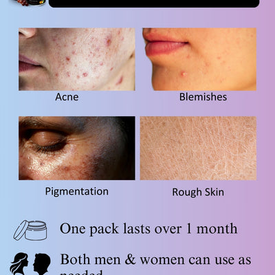 Niacinamide Anti-Acne Night Face Gel