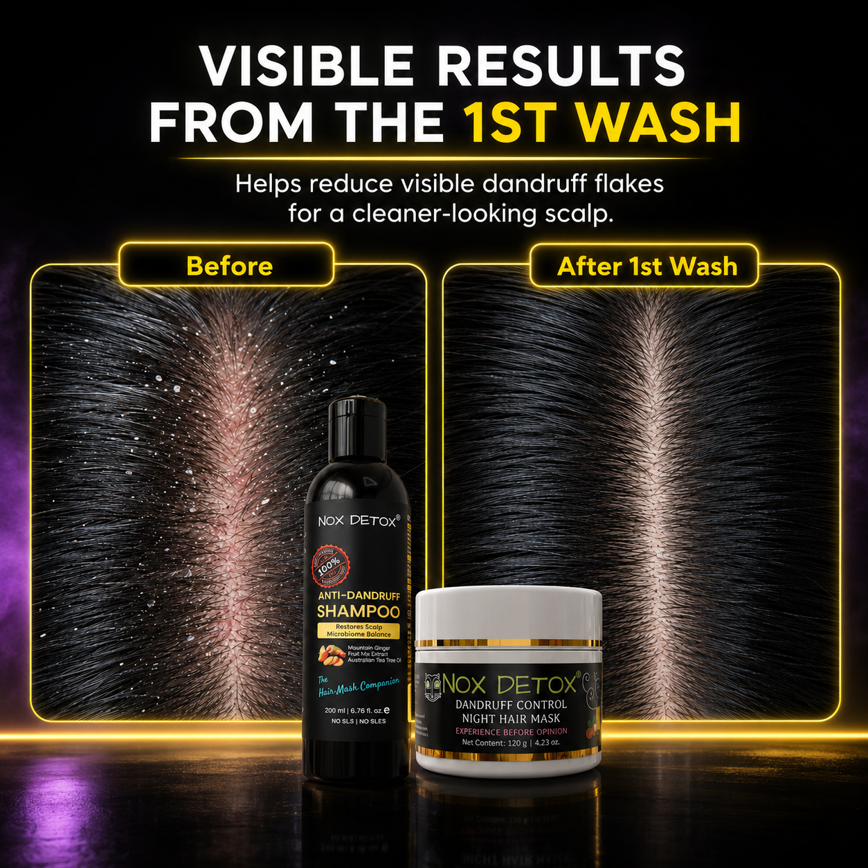 Anti-Dandruff Shampoo + Dandruff Control Night Hair Mask Combo
